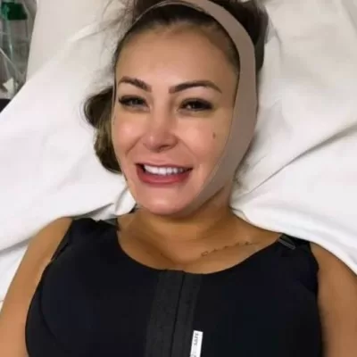 Andressa Urach remove costelas em novo procedimento